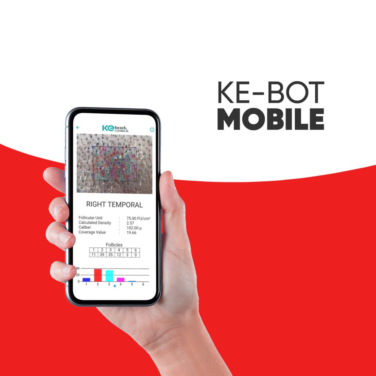 KEbot-mobile-1280x1280